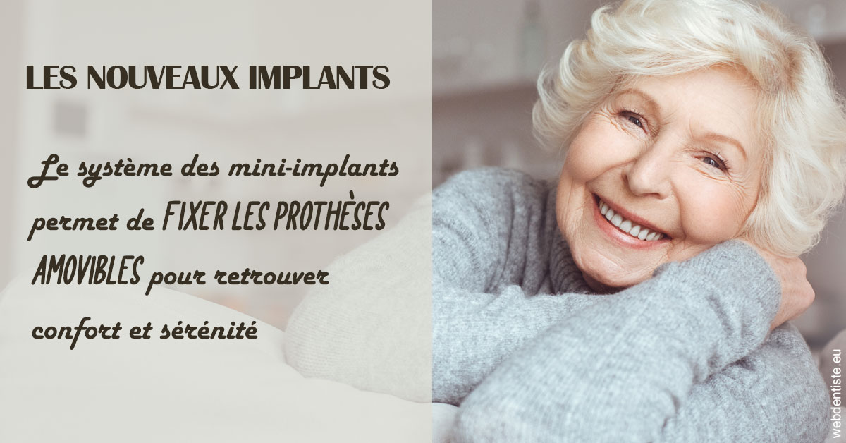 https://selarl-du-docteur-franck-wolff.chirurgiens-dentistes.fr/Les nouveaux implants 1