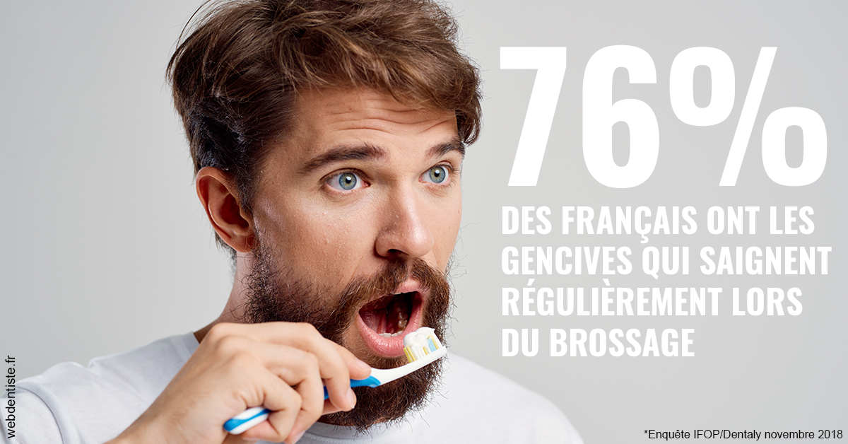 https://selarl-du-docteur-franck-wolff.chirurgiens-dentistes.fr/76% des Français 2
