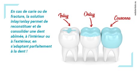 https://selarl-du-docteur-franck-wolff.chirurgiens-dentistes.fr/L'INLAY ou l'ONLAY