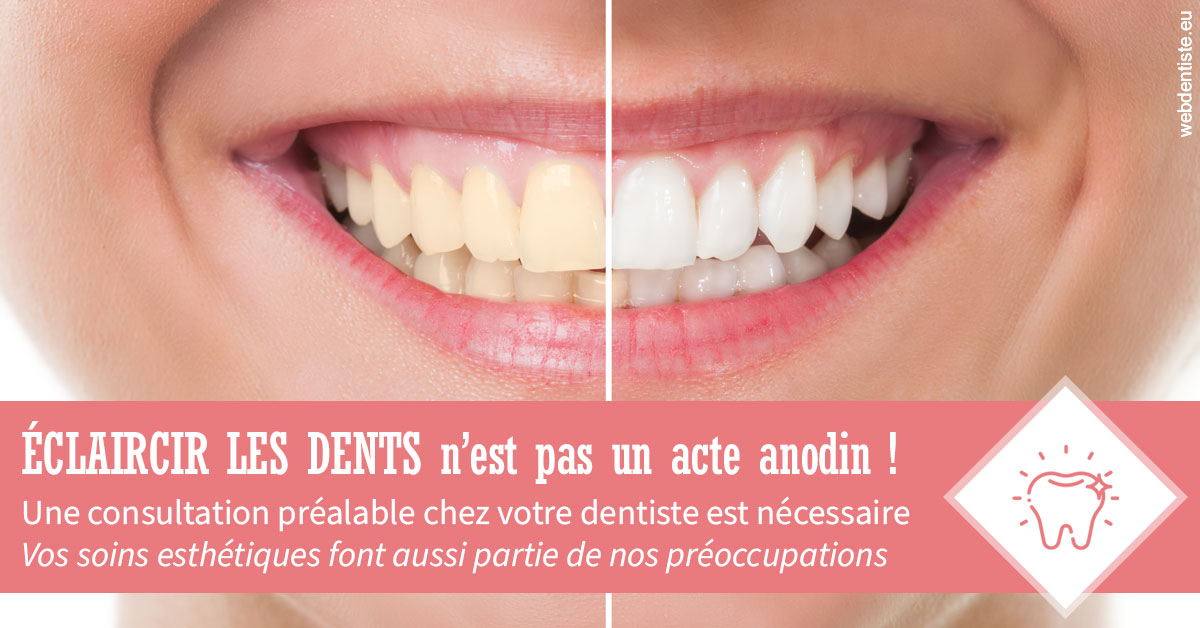 https://selarl-du-docteur-franck-wolff.chirurgiens-dentistes.fr/Eclaircir les dents 1