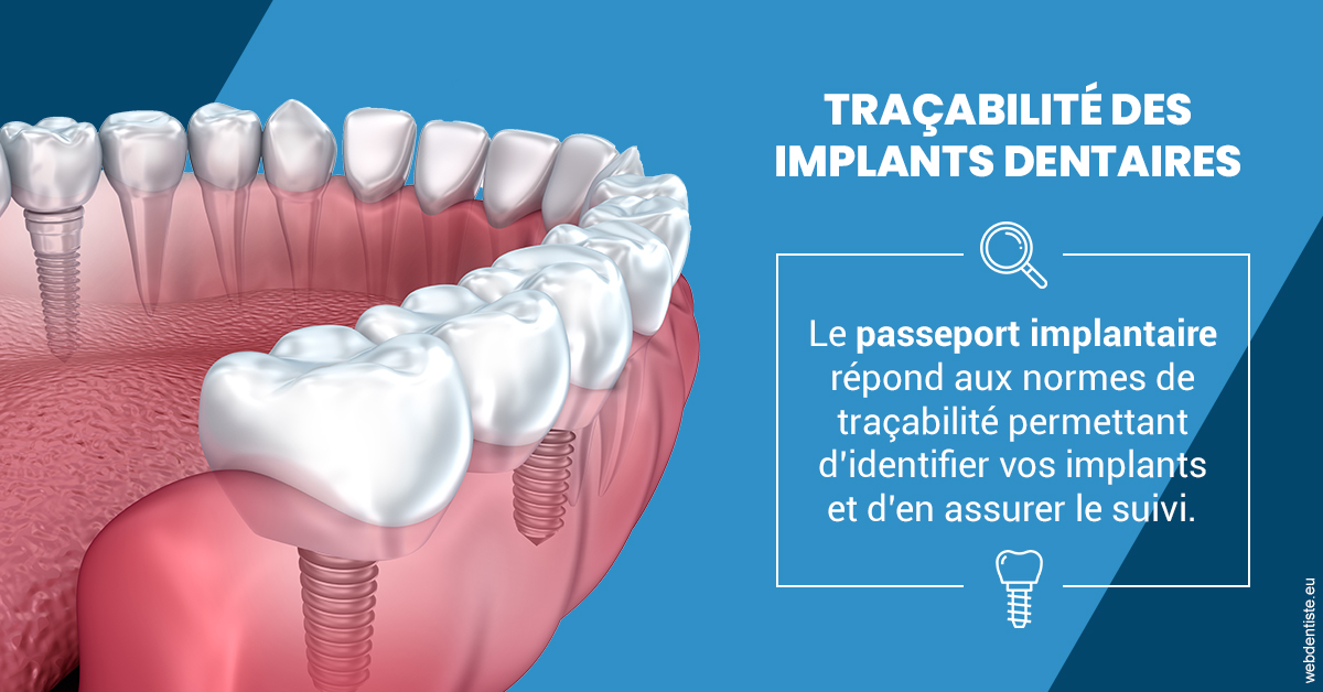 https://selarl-du-docteur-franck-wolff.chirurgiens-dentistes.fr/T2 2023 - Traçabilité des implants 1