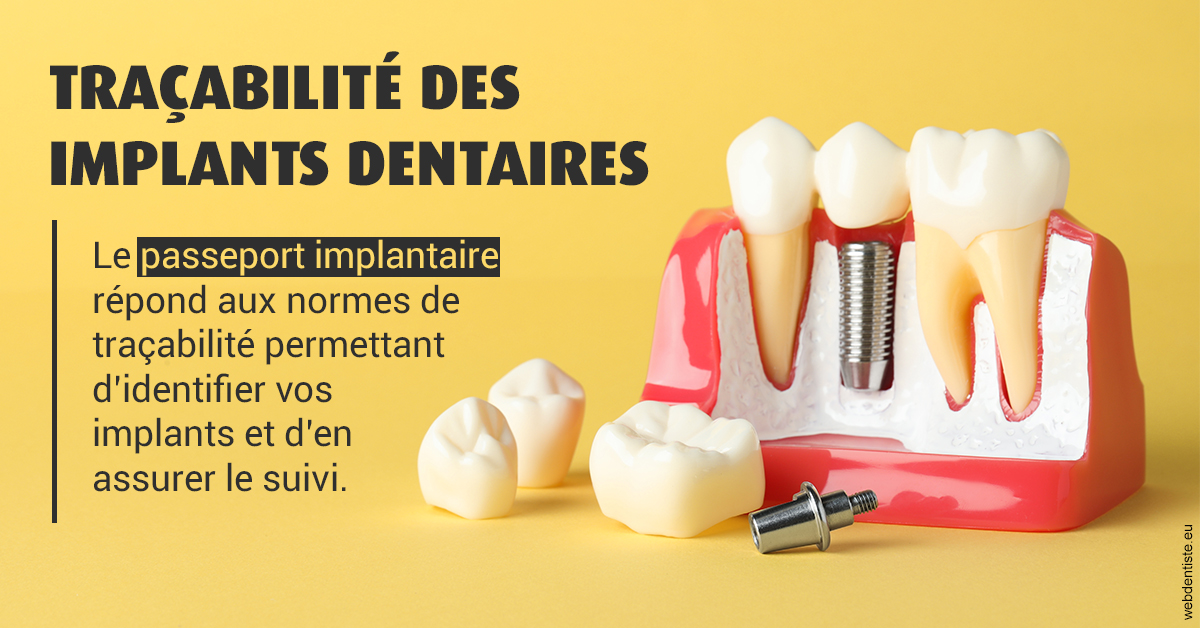 https://selarl-du-docteur-franck-wolff.chirurgiens-dentistes.fr/T2 2023 - Traçabilité des implants 2