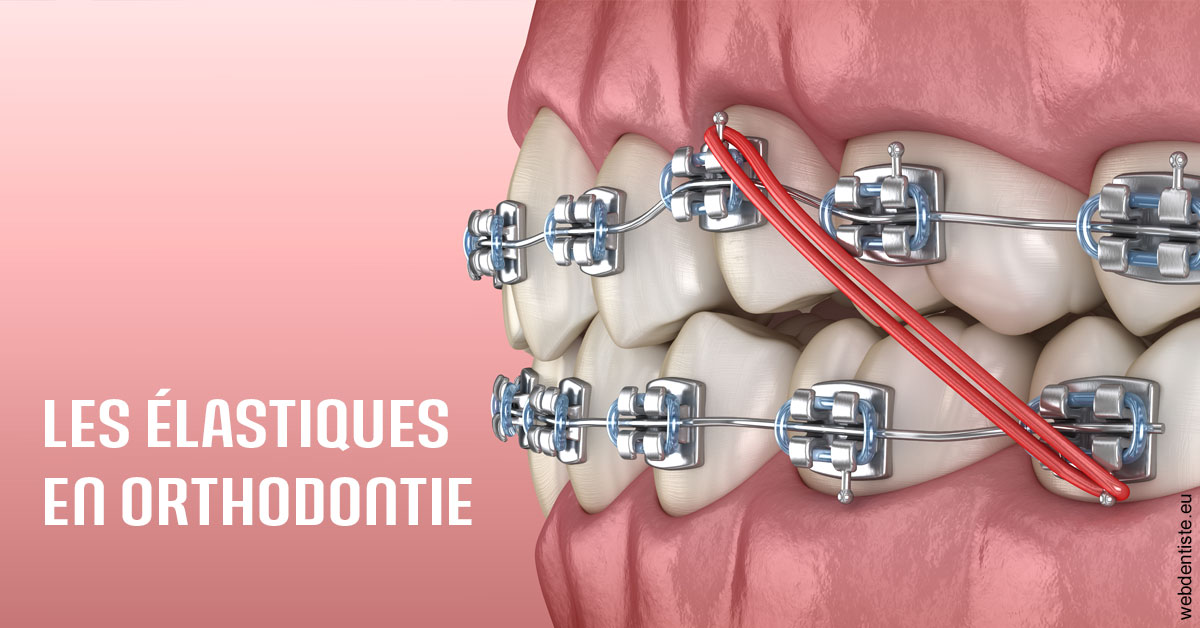 https://selarl-du-docteur-franck-wolff.chirurgiens-dentistes.fr/Elastiques orthodontie 2