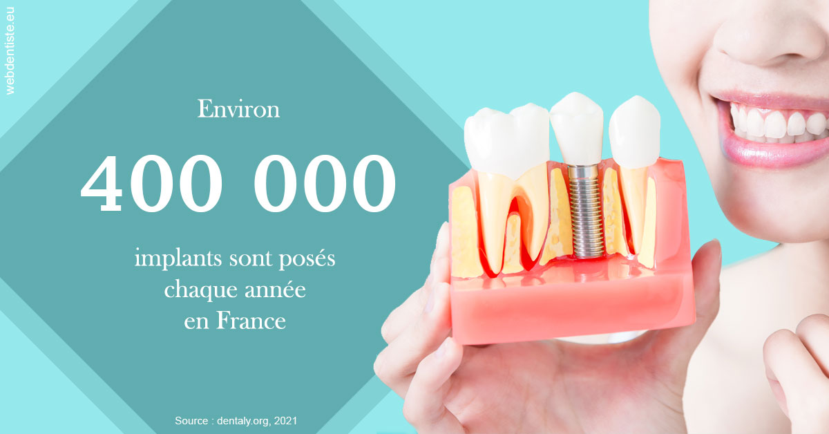 https://selarl-du-docteur-franck-wolff.chirurgiens-dentistes.fr/Pose d'implants en France 2